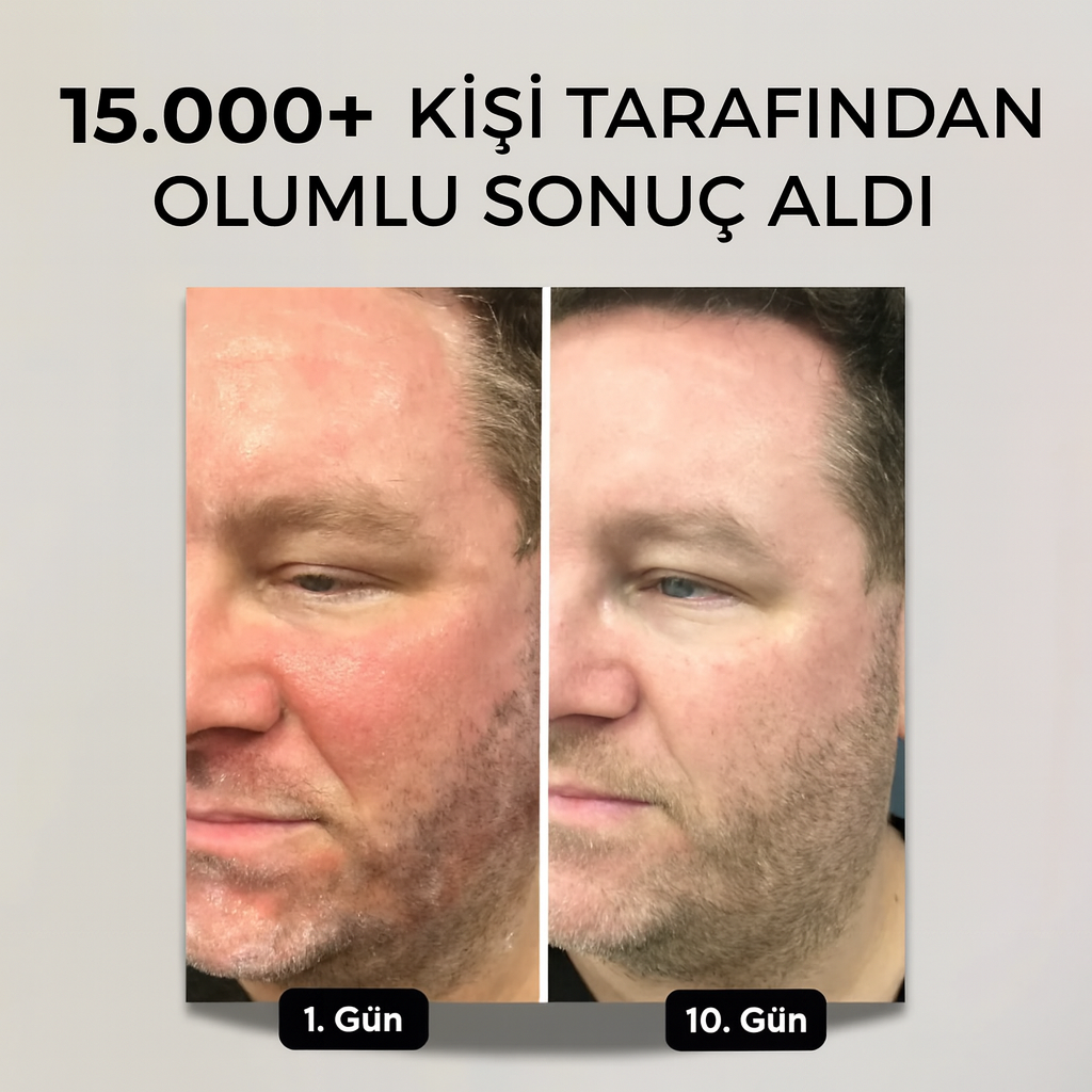 OSHRA™ - Kızarıklık/Kepek Önleyici Sakal Bakım Balmı