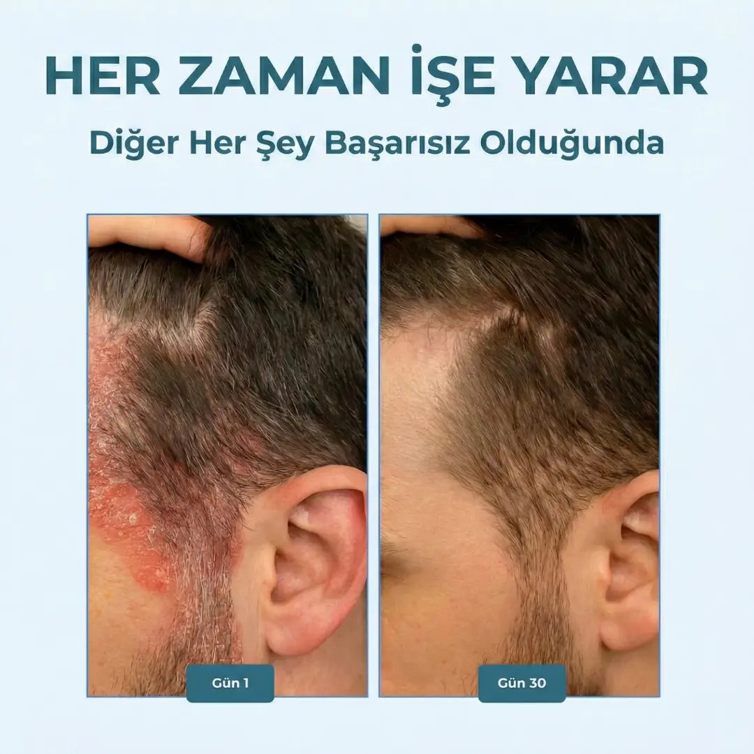 Dermafix - Atopik Dermatit Ciltler İçin Özel Onarıcı Bakım Kremi OSHRA