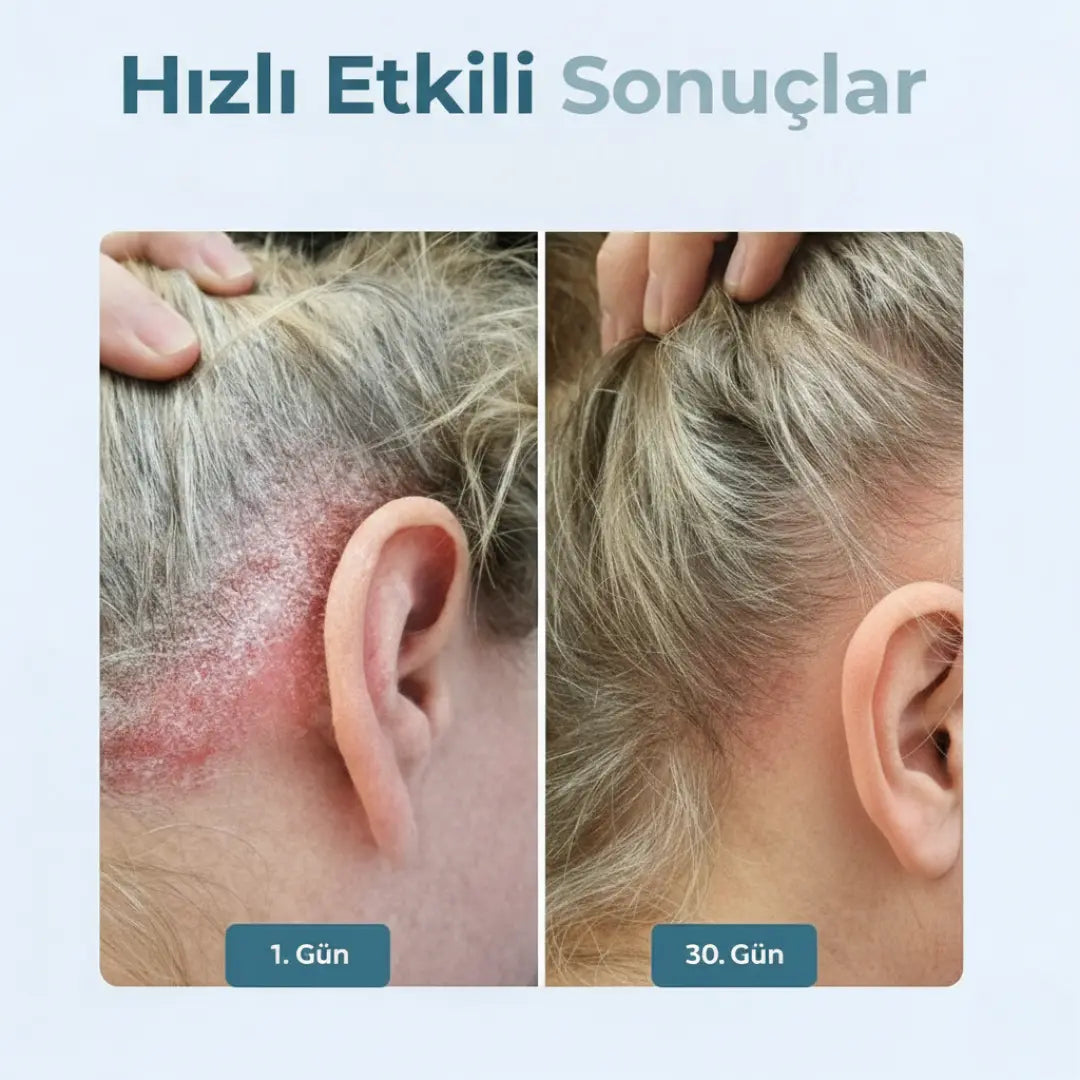 Dermafix - Atopik Dermatit Ciltler İçin Özel Onarıcı Bakım Kremi OSHRA
